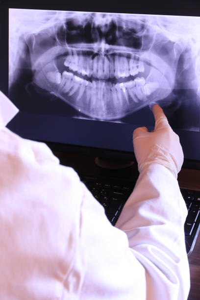 Best Root Canal Emergency Dentist  in Stockton, KS