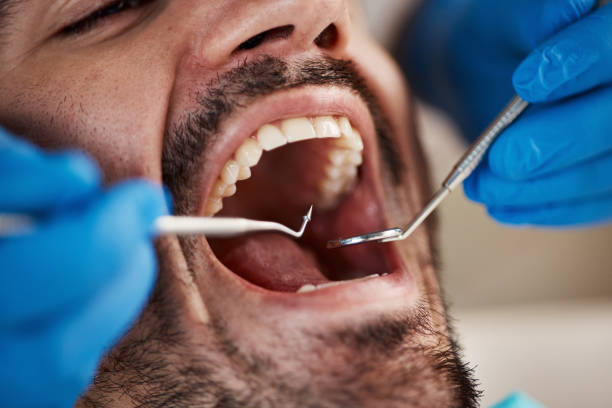 Best Root Canal Emergency Dentist  in Stockton, KS