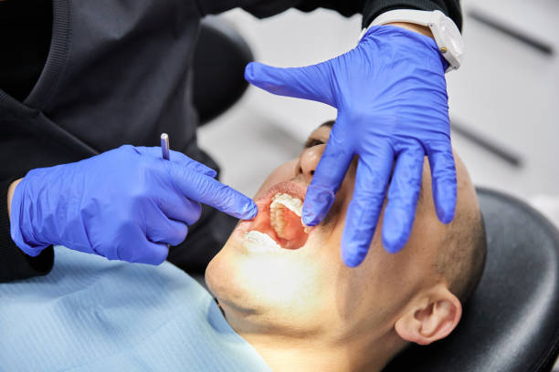 Best Teeth Whitening  in Stockton, KS